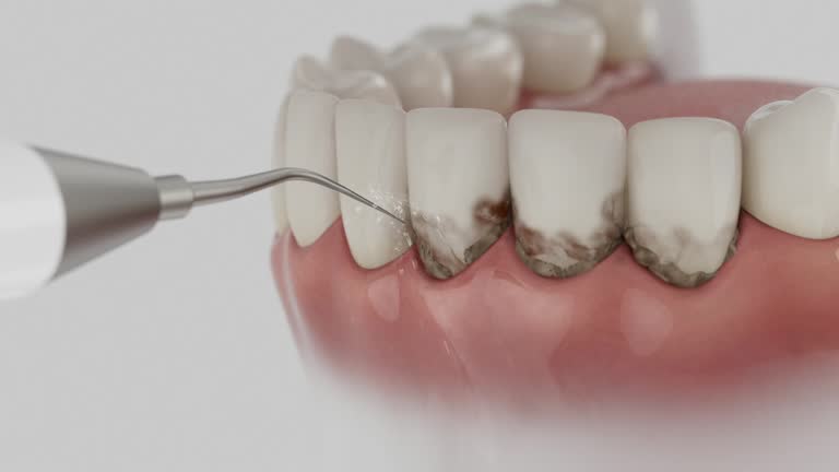 Trusted Dental Crowns And Bridges service in Evans, GA - Dentist Open Now